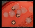 p.aeruginosa beta-hemolysis